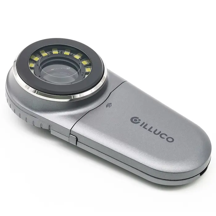 A handheld dermatoscope with a ring of LED lights around its magnifying lens